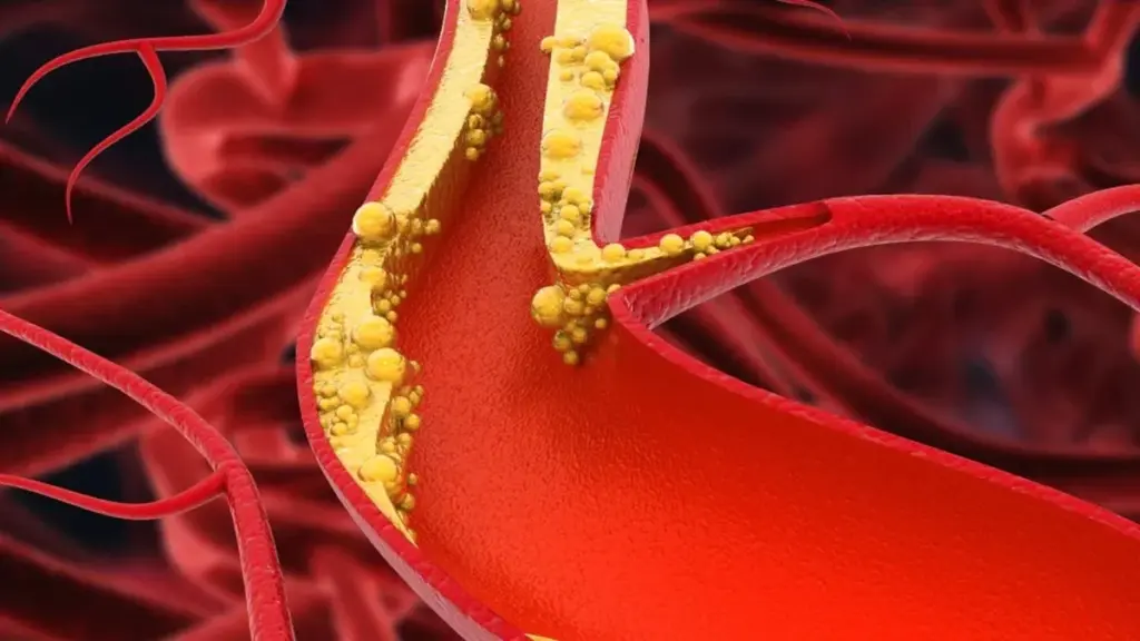 O pior alimento para as suas artérias segundo um cardiologista