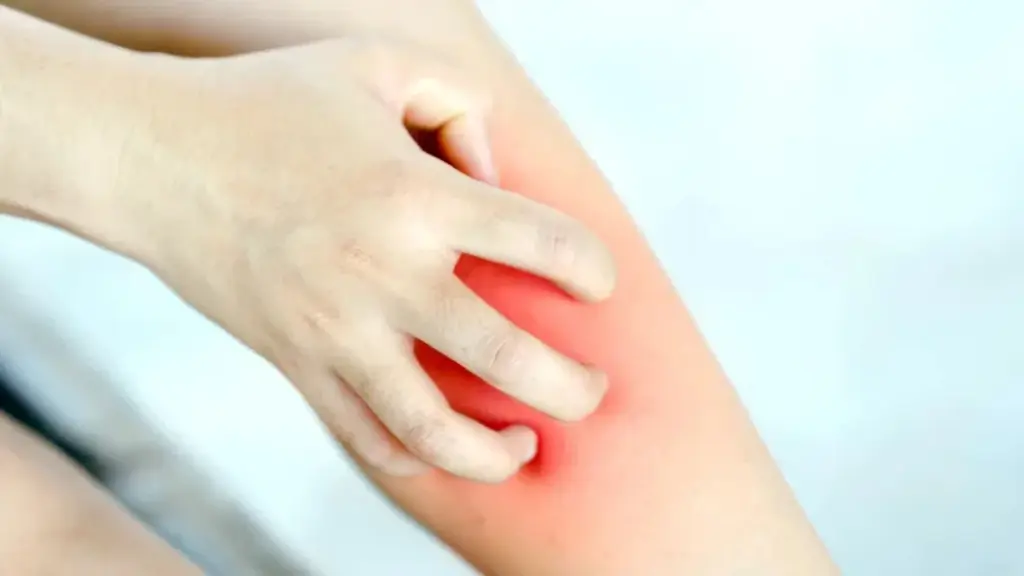 Picazón de piernas persistente: La señal que podría ocultar un problema vascular grave