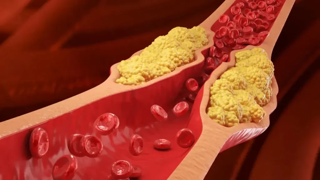 Desayunos que Hacen Magia: Baja el Colesterol Antes de las 10 AM