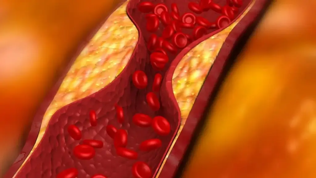 La avena: Tu arma secreta contra el colesterol malo