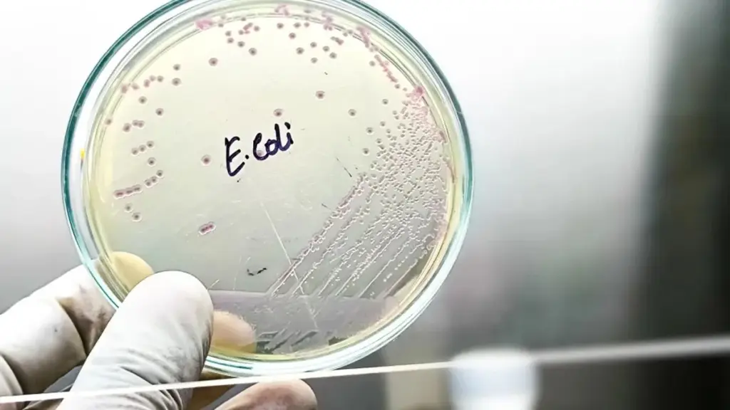 Por que alguns alimentos comuns podem ser perigosos devido à bactéria E. coli e como evitá-la
