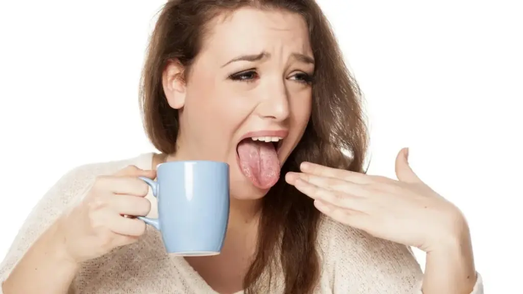 ¿Te quemaste la lengua? Esto es lo que debes hacer (y lo que evitar)