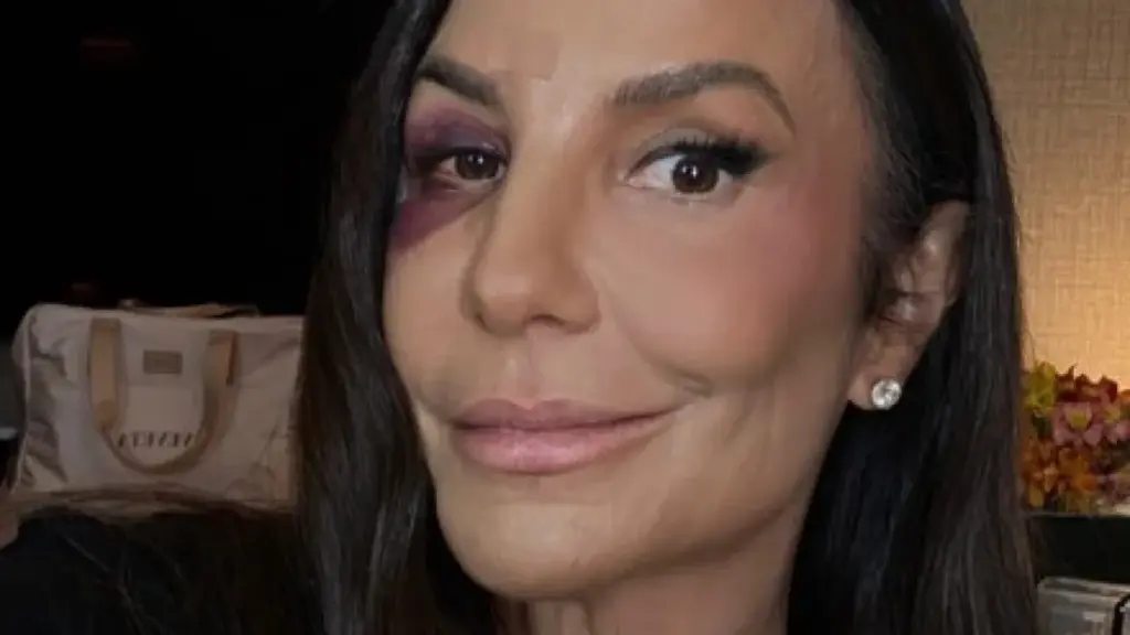 La "caída tonta": La verdadera razón detrás del desmayo de Ivete Sangalo y cómo evitarlo