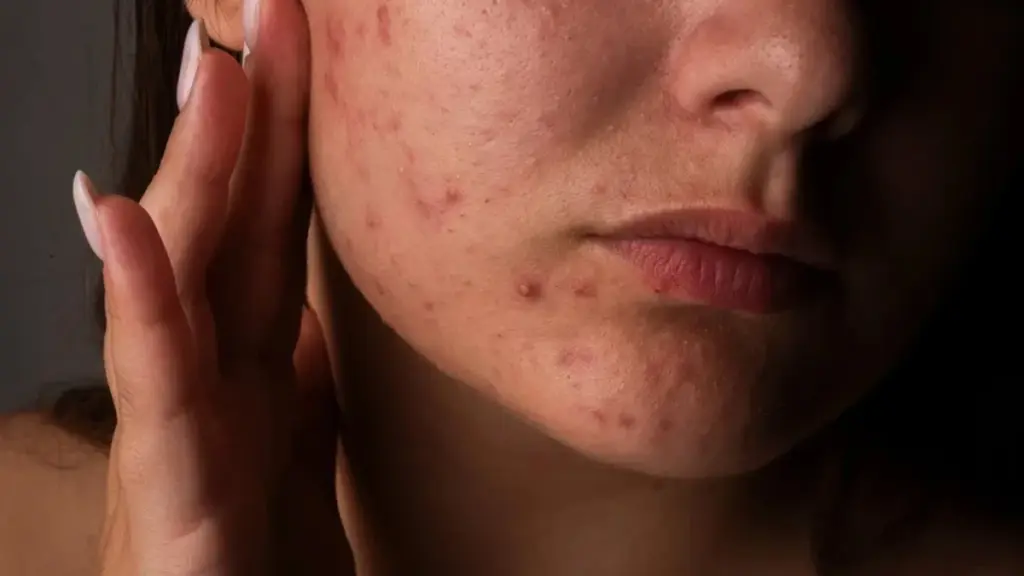 La verdad oculta: 3 errores comunes que estropean la barrera de tu piel (y cómo repararla)